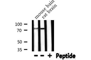 Western blot analysis of PRKCG expression in various lysates
