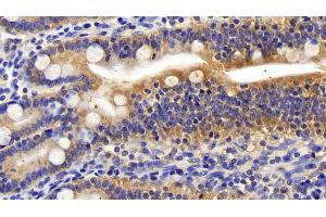 Detection of PIK3Cb in Human Small intestine Tissue using Polyclonal Antibody to Phosphoinositide-3-Kinase Catalytic Beta Polypeptide (PIK3Cb)