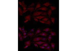 anti-Induced Myeloid Leukemia Cell Differentiation Protein Mcl-1 (MCL1) (AA 120-220) antibody