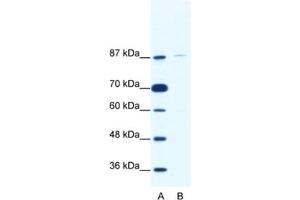 Western Blotting (WB) image for anti-TATA Box Binding Protein (TBP)-Associated Factor, RNA Polymerase I, C, 110kDa (TAF1C) antibody (ABIN2461762) (TAF1C anticorps)