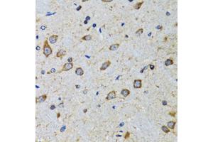 Immunohistochemistry of paraffin-embedded mouse brain using CDK1 antibody. (CDK1 anticorps)