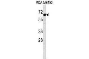 STEAP3 Antibody (C-term) western blot analysis in MDA-MB453 cell line lysates (35µg/lane). (STEAP3 anticorps  (C-Term))