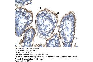 Human Intestine (FLJ20729 (C-Term) anticorps)