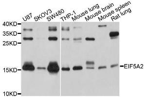 Western blot analysis of extracts of various cell lines, using EIF5A2 antibody. (EIF5A2 anticorps  (AA 1-153))