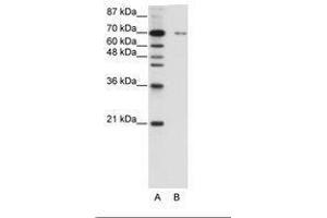 Image no. 1 for anti-Zinc Finger Protein 398 (ZNF398) (C-Term) antibody (ABIN6736187) (ZNF398 anticorps  (C-Term))