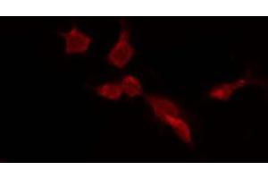 ABIN6275659 staining HepG2 by IF/ICC. (USP45 anticorps  (Internal Region))