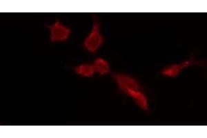 ABIN6275659 staining HepG2 by IF/ICC.