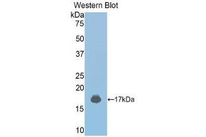 Western Blotting (WB) image for anti-Janus Kinase 2 (JAK2) (AA 689-807) antibody (ABIN3203630) (JAK2 anticorps  (AA 689-807))