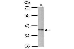 WB Image Sample (30 ug of whole cell lysate) A: 293T 10% SDS PAGE antibody diluted at 1:1000 (CCNI2 anticorps)