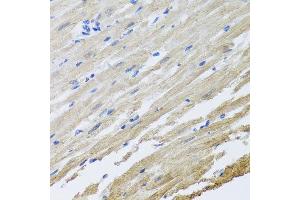 Immunohistochemistry of paraffin-embedded rat heart using SET antibody at dilution of 1:100 (x40 lens).