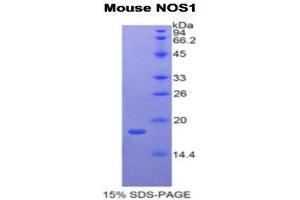 SDS-PAGE (SDS) image for Nitric Oxide Synthase 1, Neuronal (NOS1) (AA 1213-1337) protein (His tag) (ABIN2121770) (NOS1 Protein (AA 1213-1337) (His tag))