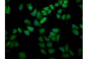 Immunofluorescence staining of Hela cells with ABIN7167644 at 1:166, counter-stained with DAPI. (UPF3B anticorps  (AA 319-423))