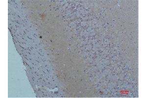 Immunohistochemistry (IHC) analysis of paraffin-embedded Rat Brain Tissue using S100 Rabbit Polyclonal Antibody diluted at 1:200.