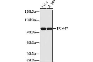 Western blot analysis of extracts of various cell lines, using TRIM47 antibody (ABIN7270991) at 1:1000 dilution.