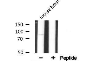 Western blot analysis on mouse brain lysate using Integrin beta-5 Antibody.