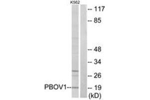 Western Blotting (WB) image for anti-Prostate and Breast Cancer Overexpressed Protein 1 (PBOV1) (AA 31-80) antibody (ABIN2889750) (PBOV1 anticorps  (AA 31-80))