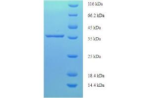 SDS-PAGE (SDS) image for PDZ and LIM Domain 3 (PDLIM3) (AA 1-189) protein (His-SUMO Tag) (ABIN5711375)