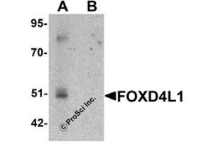 Western Blotting (WB) image for anti-Forkhead Box D4-Like 1 (FOXD4L1) (C-Term) antibody (ABIN1030401) (FOXD4L1 anticorps  (C-Term))