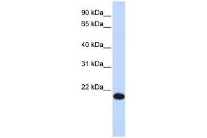 WB Suggested Anti-YAF2 Antibody Titration:  0. (YAF2 anticorps  (Middle Region))