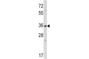 Western blot analysis of Connective Tissue Growth Factor antibody and NCI-H460 lysate.