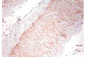 Image no. 1 for anti-Tumor Necrosis Factor alpha (TNF alpha) antibody (ABIN799618) (TNF alpha anticorps)