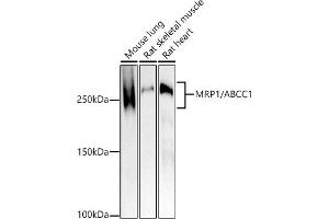 Western blot analysis of extracts of various cell lines, using MRP1/ antibody (ABIN7265736) at 1:1000 dilution. (ABCC1 anticorps)