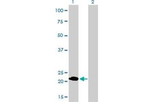 Western Blot analysis of MYL1 expression in transfected 293T cell line by MYL1 monoclonal antibody (M01), clone 2D9.
