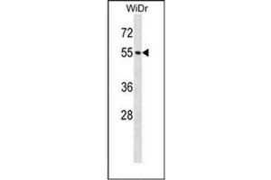 Western blot analysis of NUP50 Antibody (Center) in WiDr cell line lysates (35ug/lane). (NUP50 anticorps  (Middle Region))