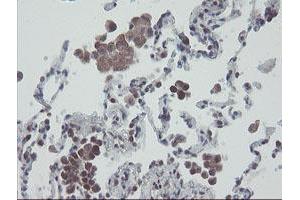 Image no. 2 for anti-RNA Binding Protein with Multiple Splicing (RBPMS) antibody (ABIN1500647)