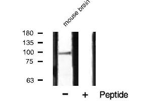 Western blot analysis of HSP90B phosphorylation expression in mouse brain tissue lysates,The lane on the right is treated with the antigen-specific peptide. (HSP90AB1 anticorps  (pSer254))