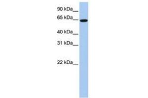 Image no. 1 for anti-EPS8-Like 1 (EPS8L1) (C-Term) antibody (ABIN6743106) (EPS8-Like 1 anticorps  (C-Term))