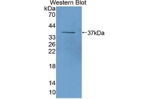 Western blot analysis of the recombinant protein. (beta-Thromboglobulin anticorps  (AA 46-107))