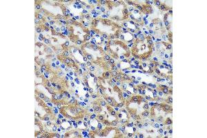 Immunohistochemistry of paraffin-embedded Mouse kidney using C18orf8 Rabbit pAb (ABIN7266379) at dilution of 1:100 (40x lens).