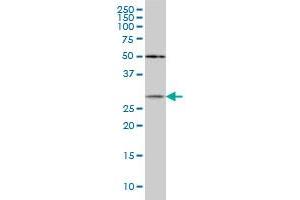 CRYBB1 monoclonal antibody (M03), clone 3D9 Western Blot analysis of CRYBB1 expression in MCF-7 .
