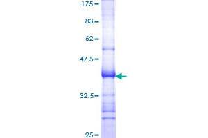 Image no. 1 for Ataxin 1 (ATXN1) (AA 576-675) protein (GST tag) (ABIN1346189)
