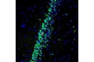Expression of Gastric inhibitory polypeptide receptor in rat hippocampus - Immunohistochemical staining of perfusion-fixed frozen rat brain sections using Anti-GIPR (extracellular) Antibody (ABIN7043209, ABIN7044412 and ABIN7044413), (1:400), followed by anti-rabbit-Alexa-488 antibody.