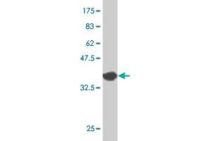Western Blot detection against Immunogen (36. (TBX3 anticorps  (AA 311-410))