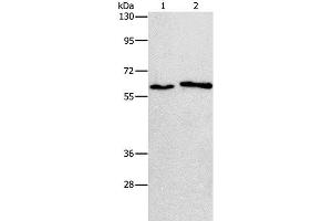 Western Blot analysis of A172 and A549 cell using CHRNA2 Polyclonal Antibody at dilution of 1:950 (CHRNA2 anticorps)