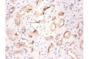 Immunohistochemistry of paraffin-embedded human kidney tissue using ABIN7175258 at dilution of 1:100 (ATP6V1F anticorps  (AA 1-119))