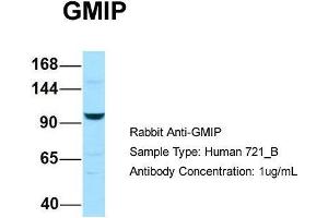 Host: Rabbit Target Name: GMIP Sample Type: Human 721_B Antibody Dilution: 1. (GMIP anticorps  (C-Term))