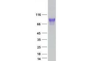 Validation with Western Blot
