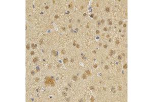 Immunohistochemistry of paraffin-embedded mouse brain using DNMT3A antibody at dilution of 1:200 (x400 lens) (DNMT3A anticorps  (AA 500-700))