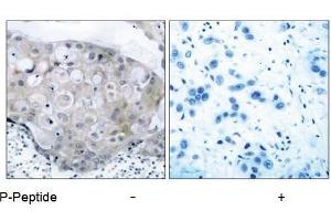 Image no. 1 for anti-VEGF Receptor 2 (VEGFR2) (pTyr951) antibody (ABIN196770) (VEGFR2/CD309 anticorps  (pTyr951))
