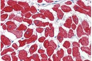 Human Heart (formalin-fixed, paraffin-embedded) stained with TNNI3 antibody ABIN462345 followed by biotinylated anti-goat IgG secondary antibody ABIN481715, alkaline phosphatase-streptavidin and chromogen.