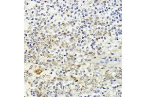 Immunohistochemistry of paraffin-embedded human tonsil using LDB1 antibody (ABIN7268255) at dilution of 1:200 (40x lens). (LIM Domain Binding 1 Protein anticorps  (AA 1-50))