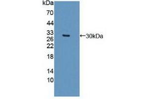 Western blot analysis of recombinant Human DCLK1. (DCLK1 anticorps  (AA 390-647))