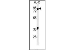 Western blot analysis of PATL1 Antibody (C-term) in HL-60 cell line lysates (35ug/lane). (PATL1 anticorps  (C-Term))