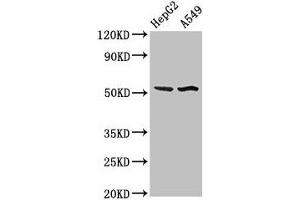 Western Blot Positive WB detected in: HepG2 whole cell lysate, A549 whole cell lysate All lanes: SPRED1 antibody at 3 μg/mL Secondary Goat polyclonal to rabbit IgG at 1/50000 dilution Predicted band size: 51 kDa Observed band size: 51 kDa (SPRED1 anticorps  (AA 123-311))