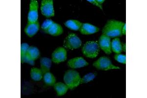 IF analysis of IDH2 using anti-IDH2 antibody (ABIN7602785).