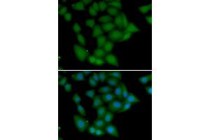 Immunofluorescence analysis of U2OS cells using CAMK1 antibody. (CAMK1 anticorps)